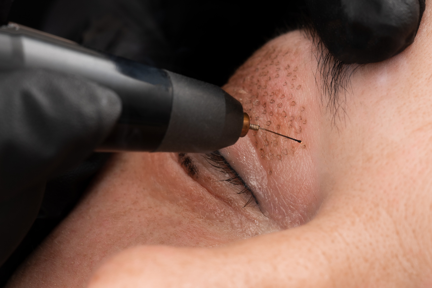 Wenn Sie auf der Suche nach einer zuverlässigen und professionellen Lippenpigmentierung in Karlsruhe sind, dann sind Sie bei uns genau richtig! Wir sind ein Team von erfahrenen und zertifizierten Pigmentierern, die sich auf die Erstellung von perfekten Lippenkonturen spezialisiert haben.